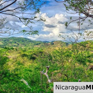 Remanso Hills Forested Views